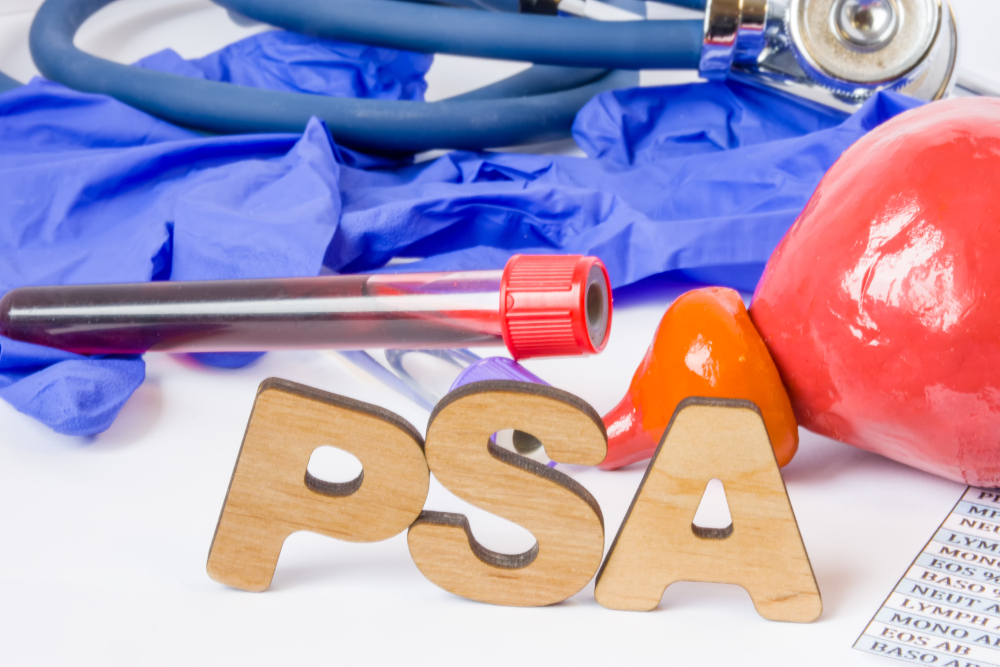 Il PSA nella prevenzione urologica Il PSA nella prevenzione urologica