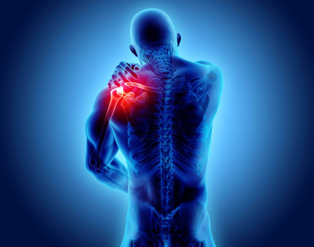 Possibilità chirurgiche nelle lesioni massive della cuffia dei rotatori Possibilità chirurgiche nelle lesioni massive della cuffia dei rotatori