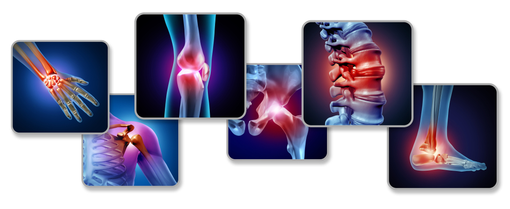 Centro della Fibromialgia Centro della Fibromialgia
