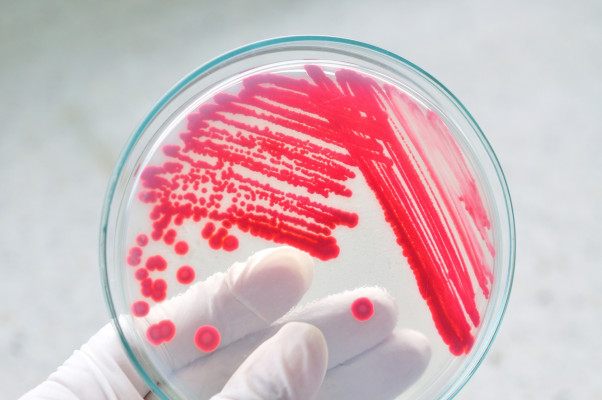 Rischi biologici Rischi biologici
