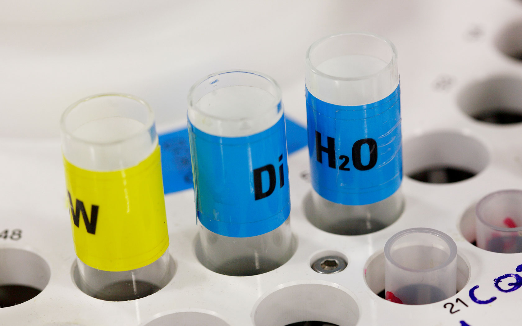 Epatite C: la sfida per l’eradicazione Epatite C: la sfida per l’eradicazione