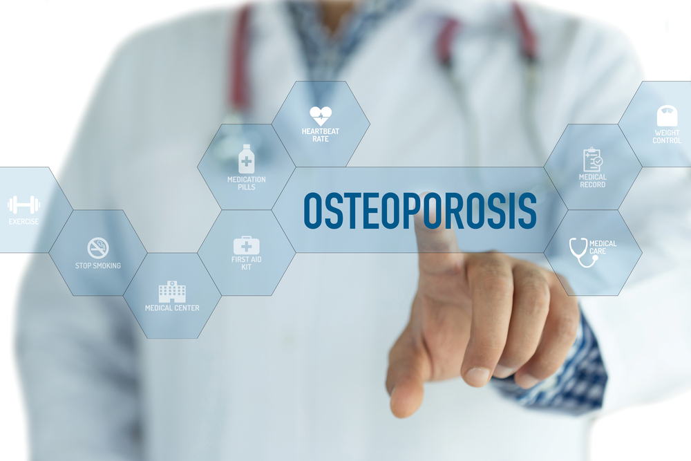 Osteoporosi: come accorgersene