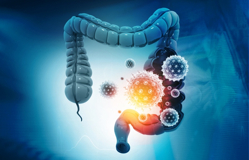 Il Pannello Colon. La Farmacogenomica: KRAS NRAS BRAF per il tumore al colon Il Pannello Colon. La Farmacogenomica: KRAS NRAS BRAF per il tumore al colon