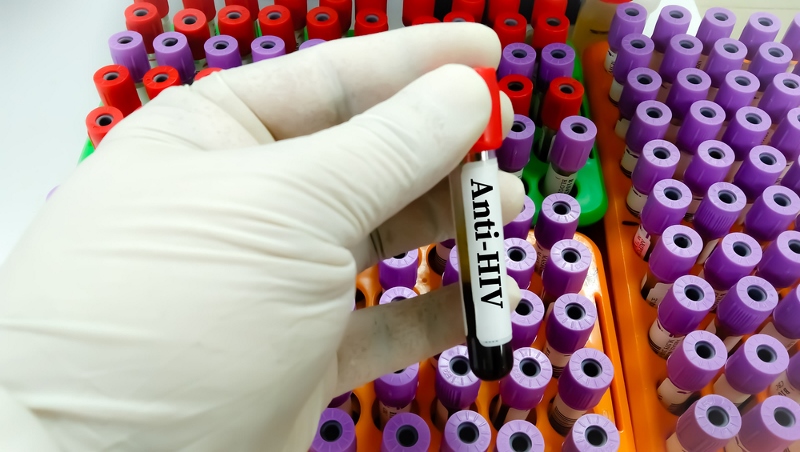 Il pacchetto di esami di laboratorio per le Malattie Sessualmente Trasmesse