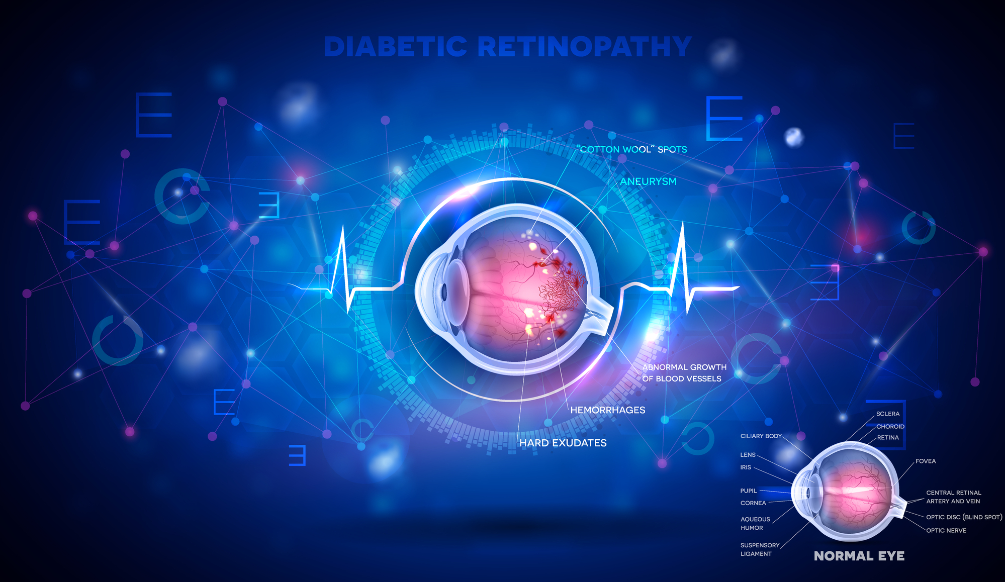 21/03: Il ruolo degli adiuvanti terapeutici nel trattamento delle patologie retiniche 21/03: Il ruolo degli adiuvanti terapeutici nel trattamento delle patologie retiniche