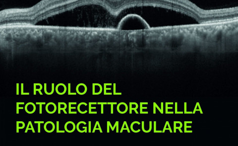 patologia maculare