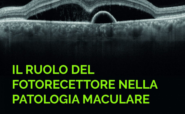 patologia maculare