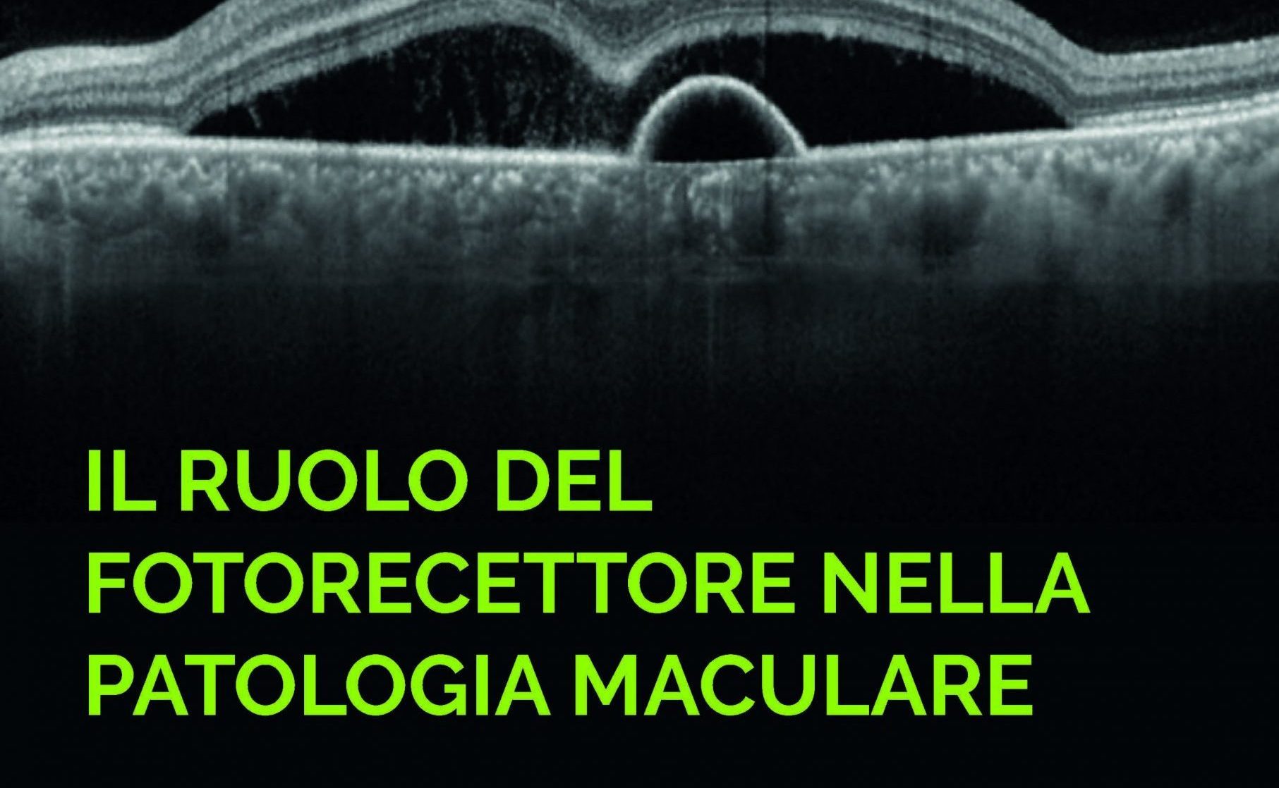 patologia maculare